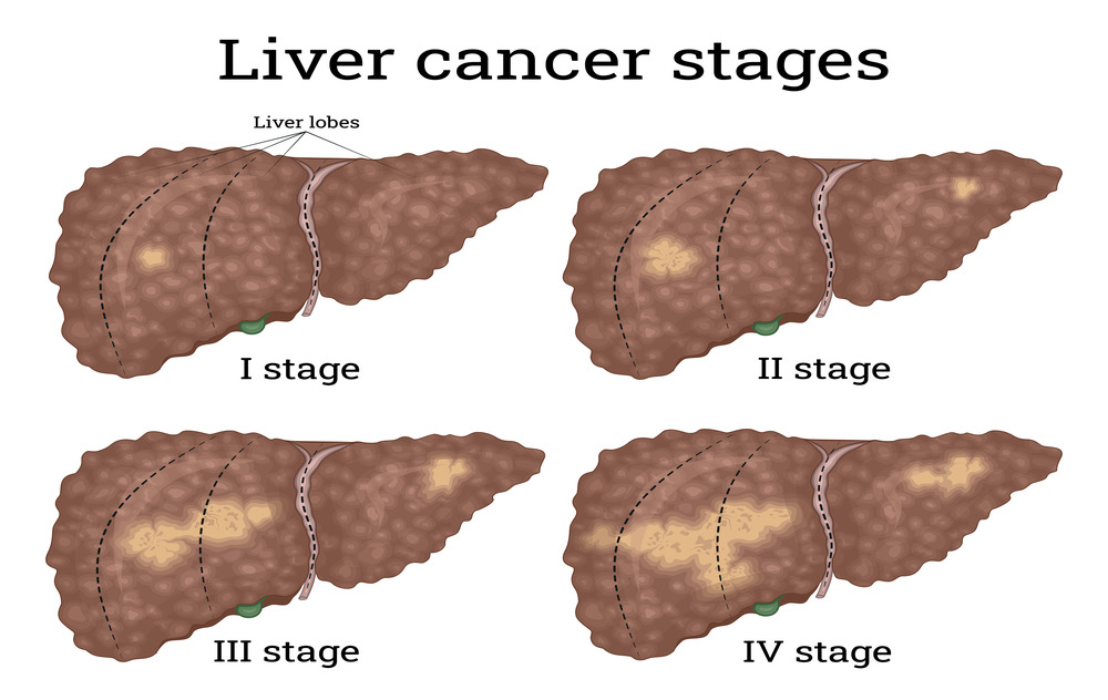 research on cancer liver